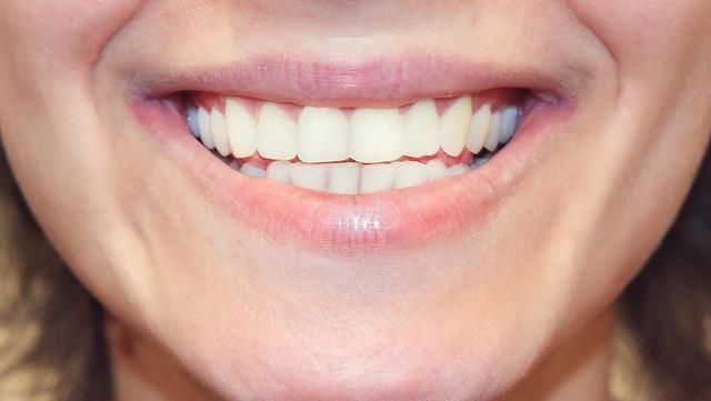 早就洗牙了为什么刷牙还是出血