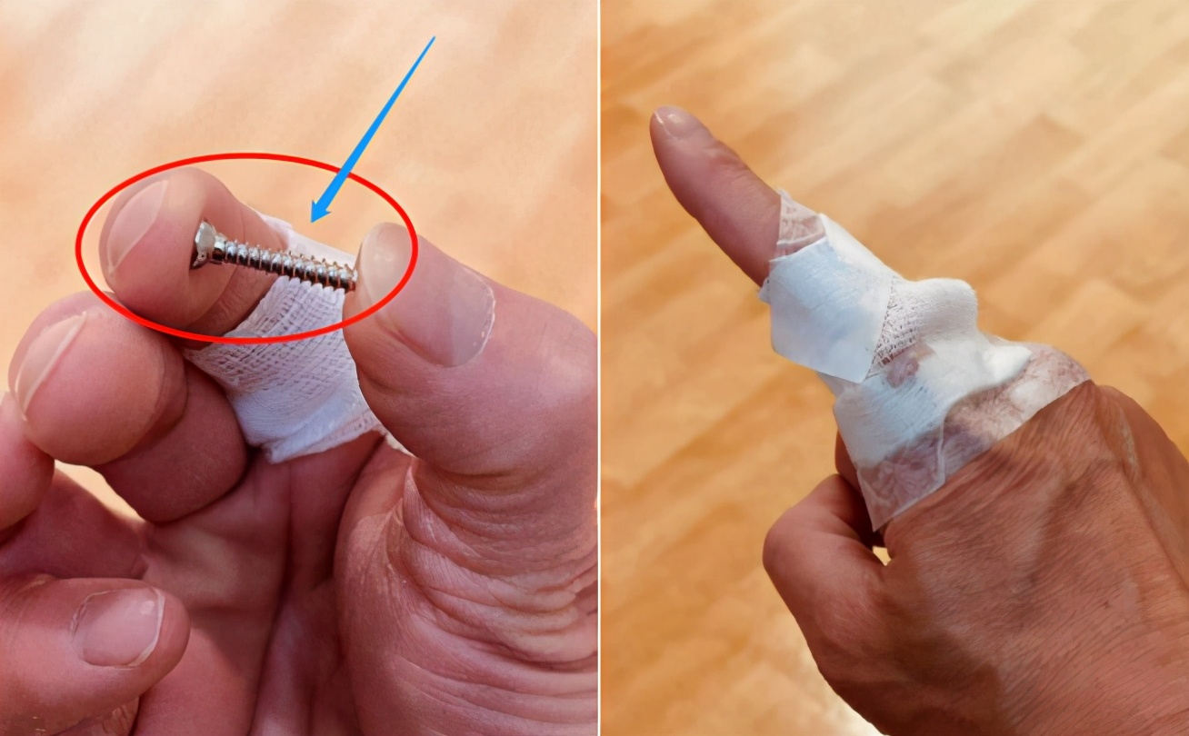 知名男星陶喆自曝车祸经历,手部植入钢钉15年,险些滚落悬崖下