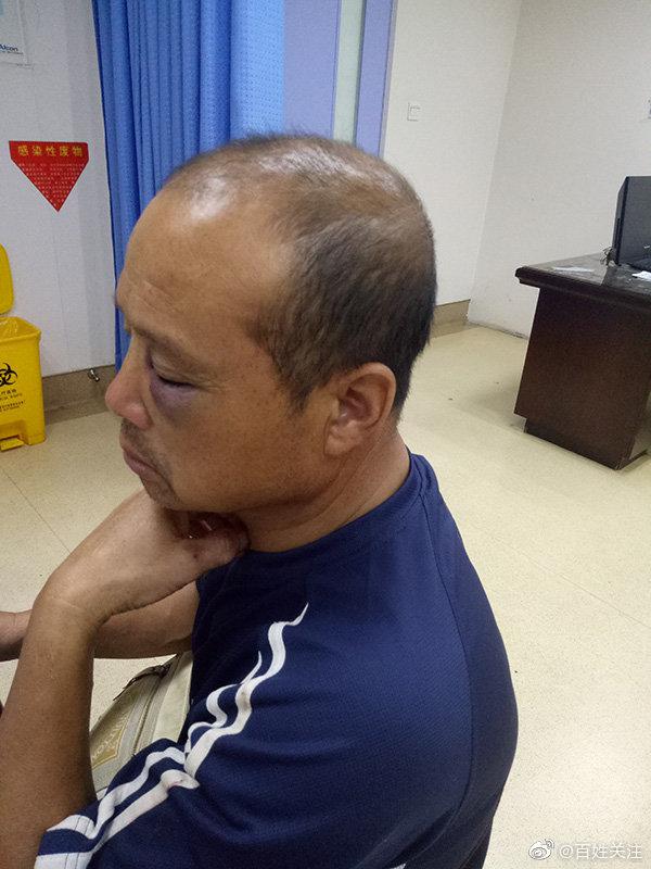 5年4次起诉离婚男方发声,男方否认家暴:给我一千万也不想离婚休闲区蓝鸢梦想 - Www.slyday.coM 5年4次起诉离婚男方发声,男方否认家暴:给我一千万也不想离婚休闲区蓝鸢梦想 - Www.slyday.coM