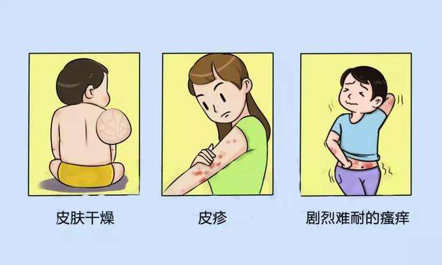 如何避免诱发特应性皮炎