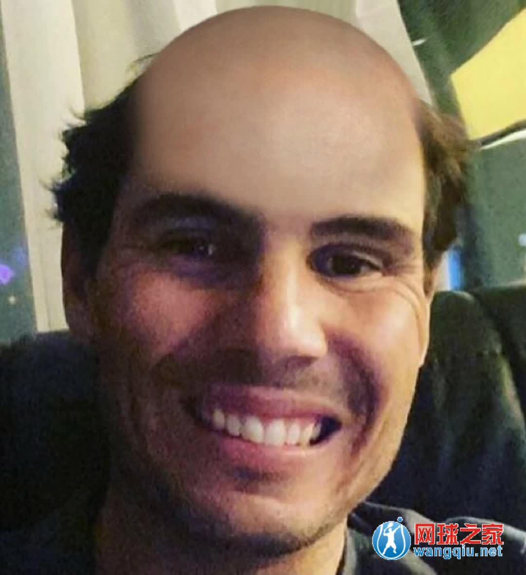 假如他们半秃头