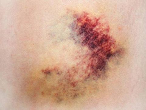 身体出现5种异常表现或是肝癌来临前的警报劝你立即就医