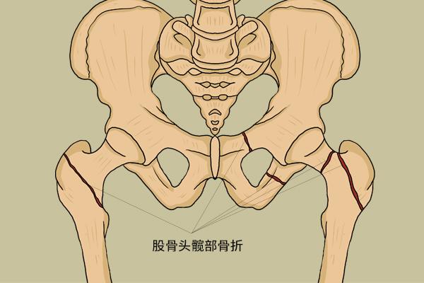 50岁左右,浑身酸痛,应该怎么调理呢?