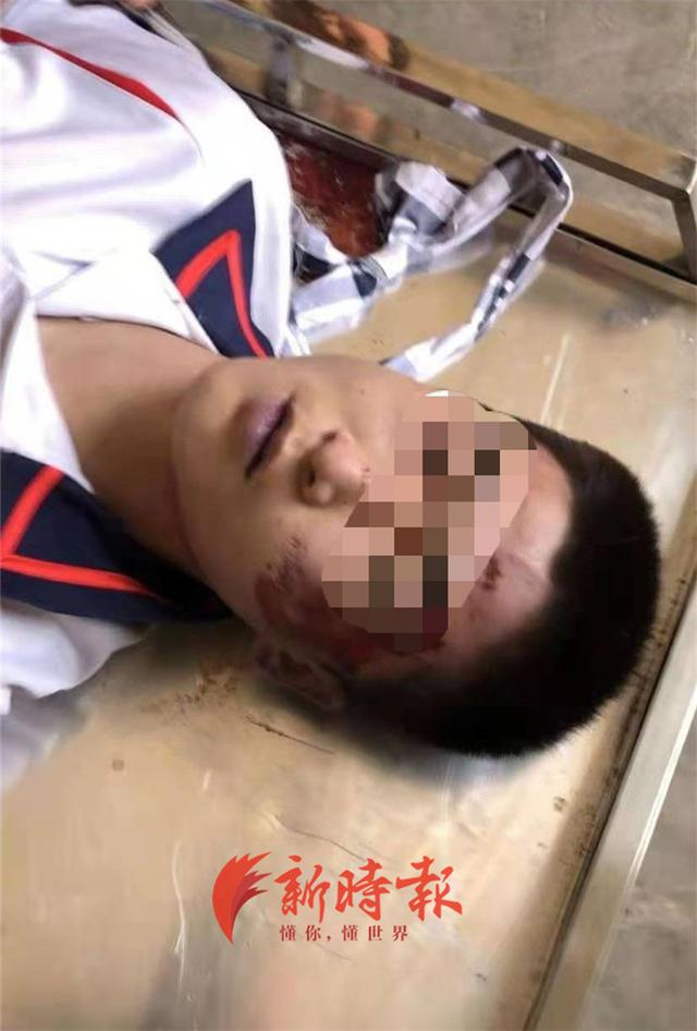河北肃宁高一学生死亡,家属怀疑遭校园暴力,警方推测为"失恋"