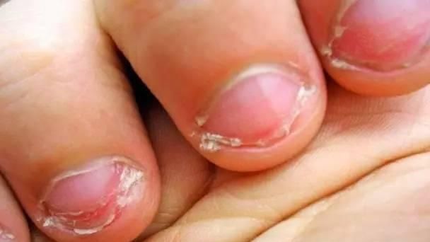 为什么宝宝爱吃"手指"到底好不好?