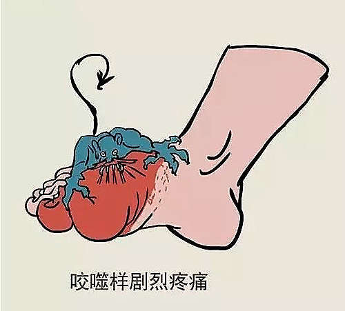 为什么痛风一到晚上就容易发作