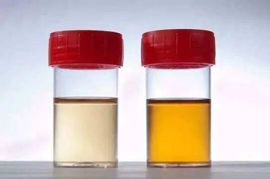 三种食物劝你少碰加速肝脏癌变