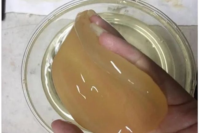 妈妈解释说,这个东西叫"醋宝".