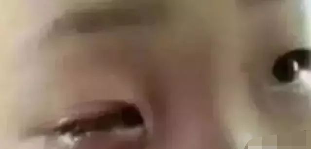 触目惊心!12岁男孩在托管所被同学浇入502胶水,右眼皮死死黏住休闲区蓝鸢梦想 - Www.slyday.coM