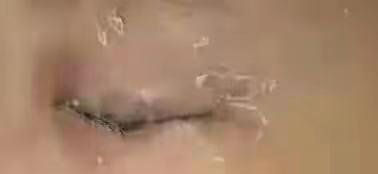 触目惊心!12岁男孩在托管所被同学浇入502胶水,右眼皮死死黏住休闲区蓝鸢梦想 - Www.slyday.coM