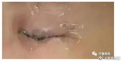 12岁男孩在托管班右眼被同学浇502胶水休闲区蓝鸢梦想 - Www.slyday.coM