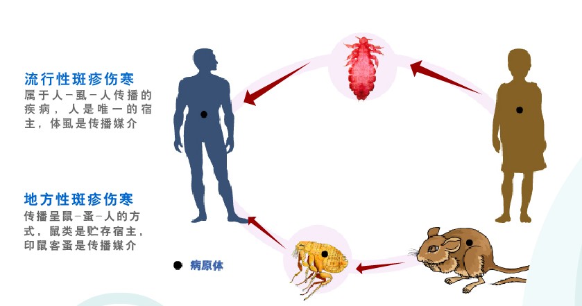 斑疹伤寒是由立克次体引起的传染病,一般通过体虱或者跳蚤传播,往往会