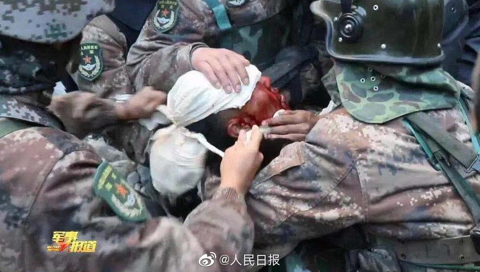 英雄团长祁发宝头上伤痕仍明显休闲区蓝鸢梦想 - Www.slyday.coM