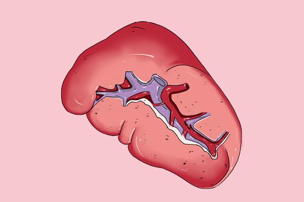 图片[1]-小孩脾脏切除后有什么影响-乐学小窝