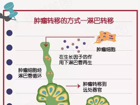 癌症转移癌细胞最容易转移至哪些部位