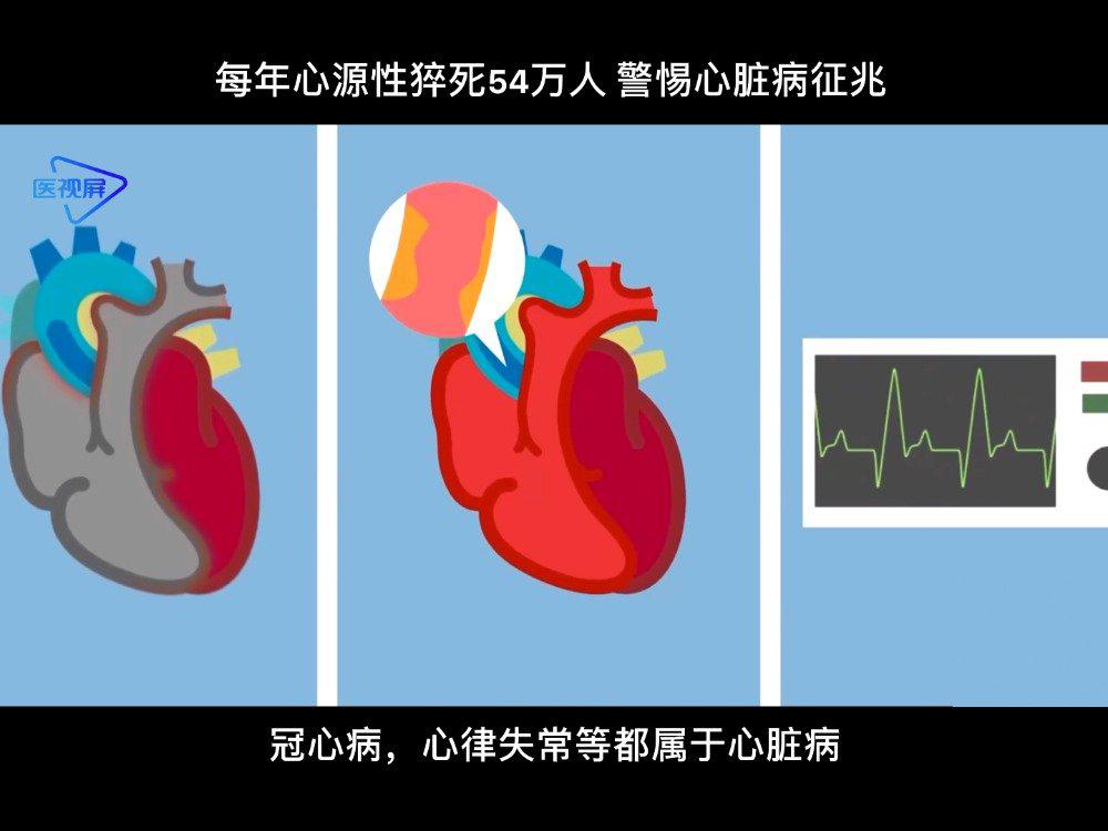 每年心源性猝死54万人 警惕心脏病征兆_新浪新闻