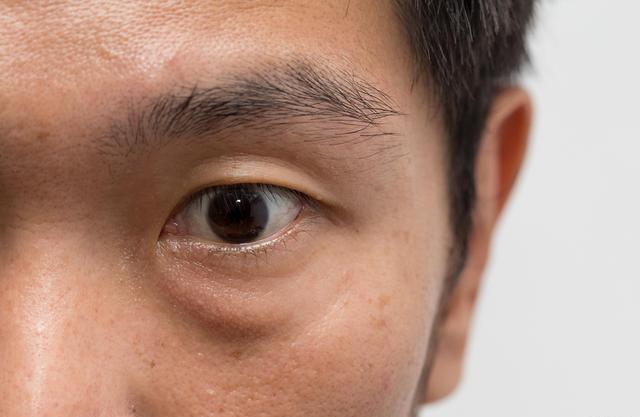 男人老不老,看"晨起"的6个表现就知道,中招的人,请及早保养|眼袋|中招