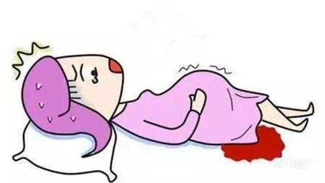 自然流产是个什么样子,有点害怕|自然流产|内膜|孕囊_新浪新闻