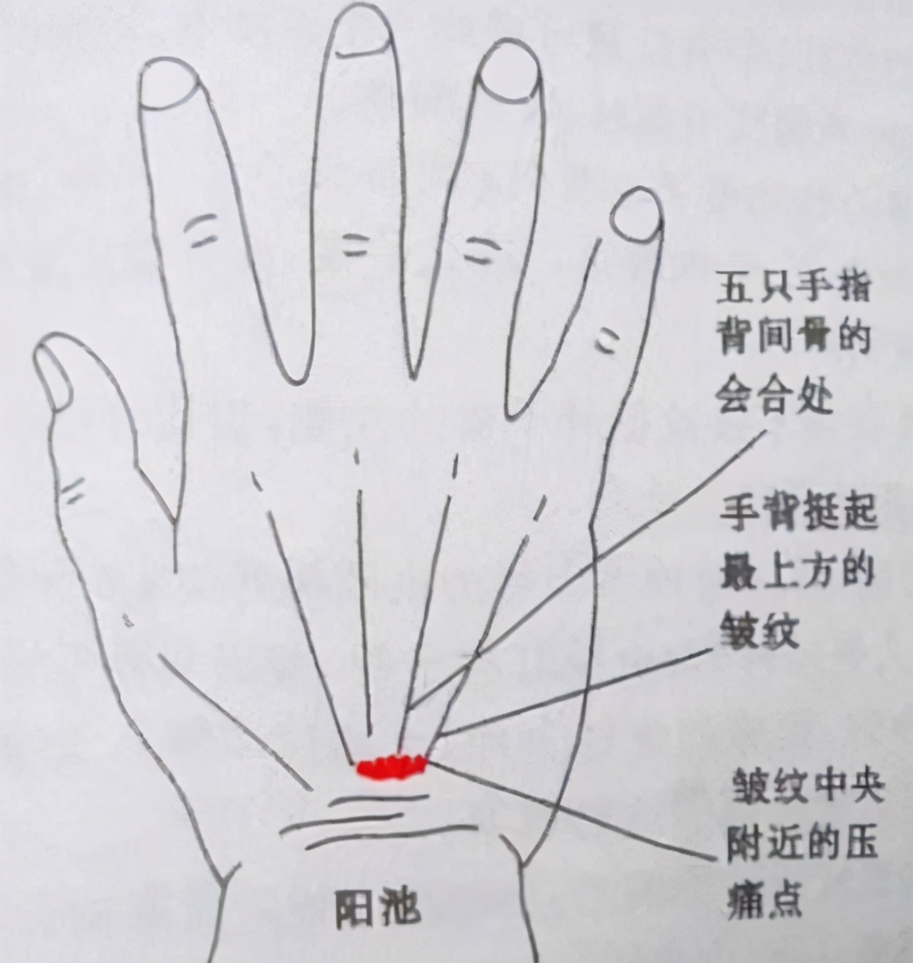 当指伸肌腱的尺侧缘凹陷的位置,有一处穴位,叫阳池穴