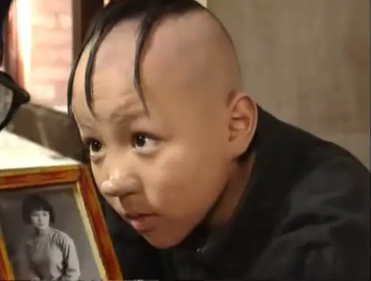 三毛长大了34岁变帅哥自嘲是过气童星曾为植发缝300多针