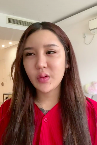 网红整容上百次出现后遗症天气太热导致玻尿酸融化额头凹了一块