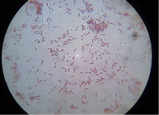 350万年前的芽孢杆菌,能让人实现永生?科学家注射了该细菌