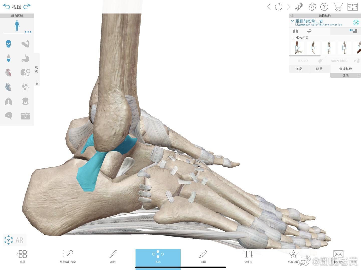 一般打篮球落地时踝关节内翻扭伤会使图中这三条韧带损伤