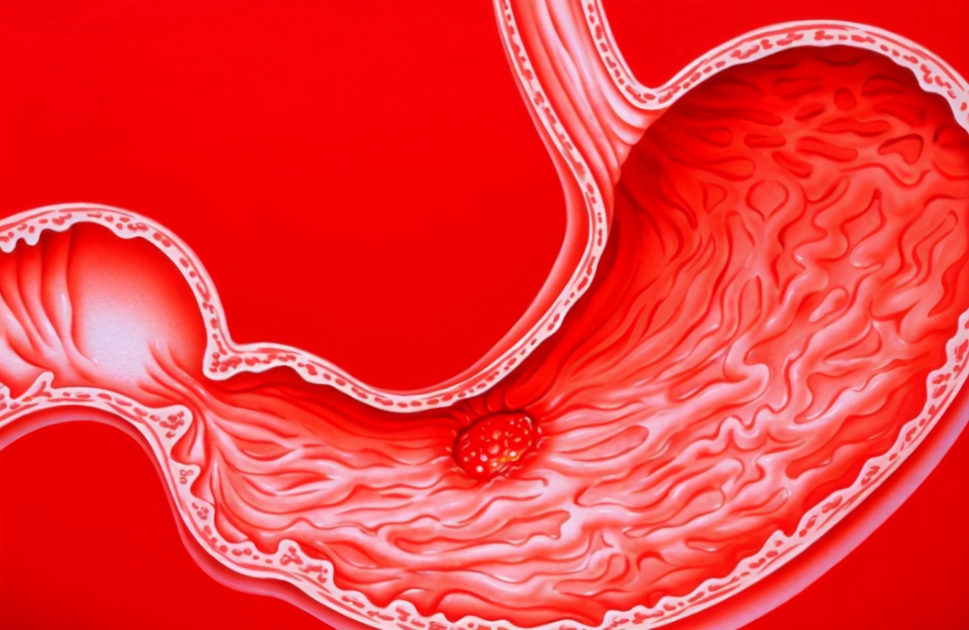 胃粘膜修复器公布并非热牛奶若你爱喝抑酸养胃胃越来越强