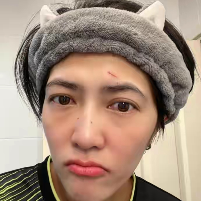 女排亚洲冠军出征世联赛前"破相",今年恐是谢幕战|维拉万|普莱姆基特