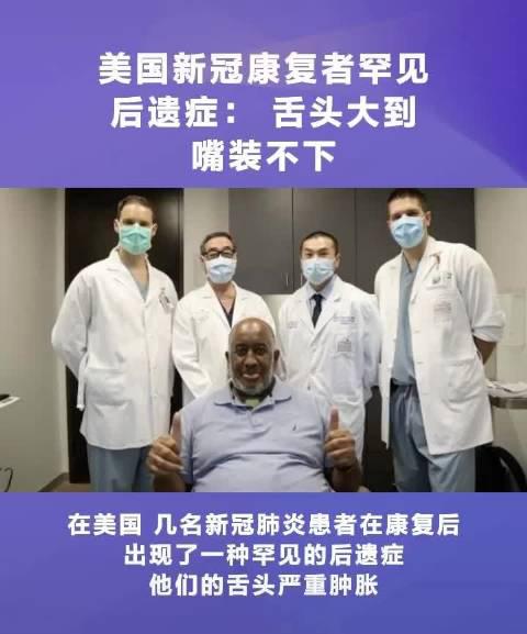 美国新冠康复者出现巨舌症,舌头大到嘴巴装不下