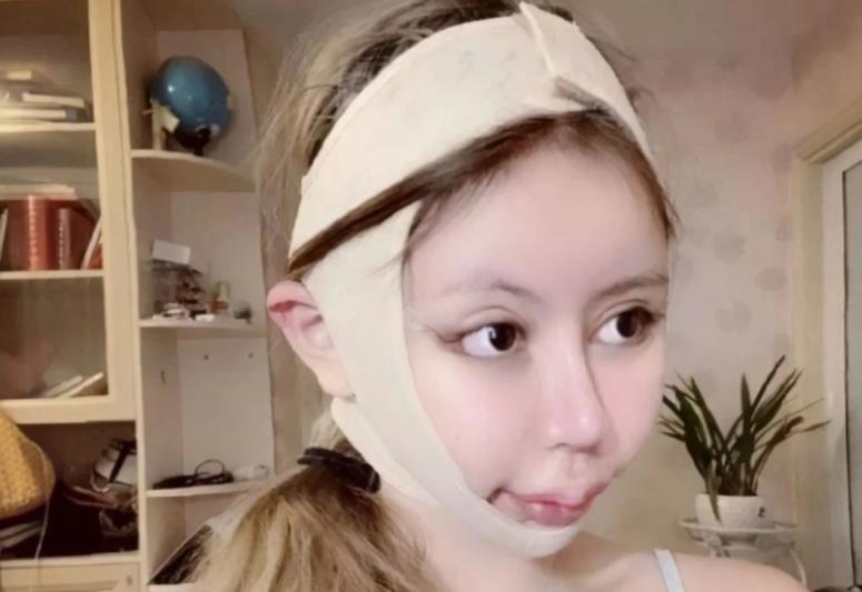 16岁网红学迪丽拉整成真人芭比整容60次花400万素颜把我看愣