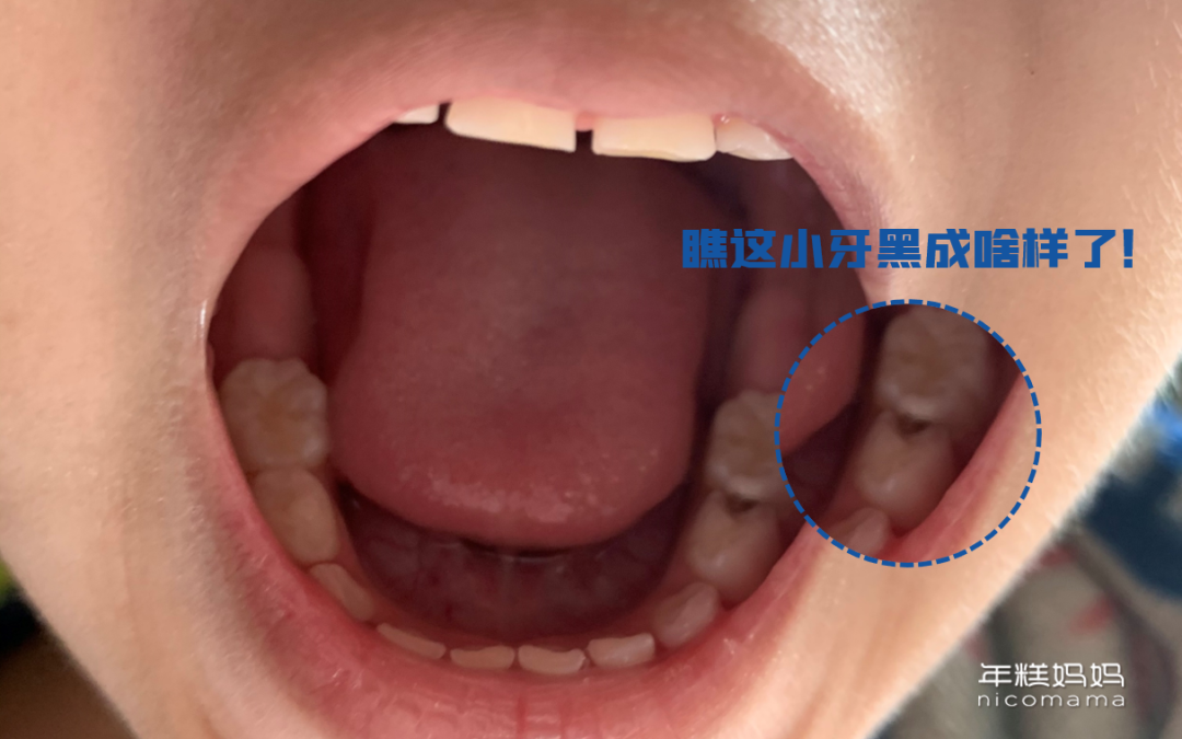 医生不建议孩子自己刷牙，竟然是因为这个！休闲区蓝鸢梦想 - Www.slyday.coM