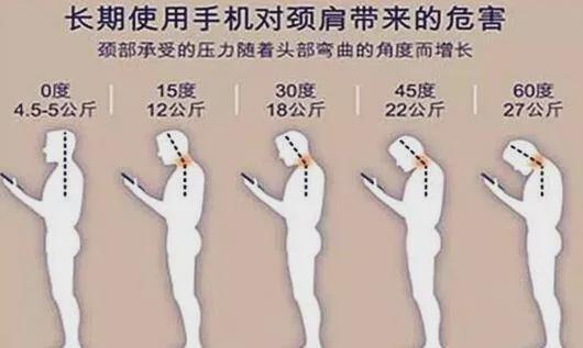 每天低头超过两小时, 脖子长了个包出来,那就越不好看了