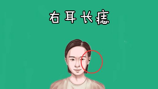 而痣的位置不同,就会有"左右有财"的说法,而女人右耳的位置处长有吉痣