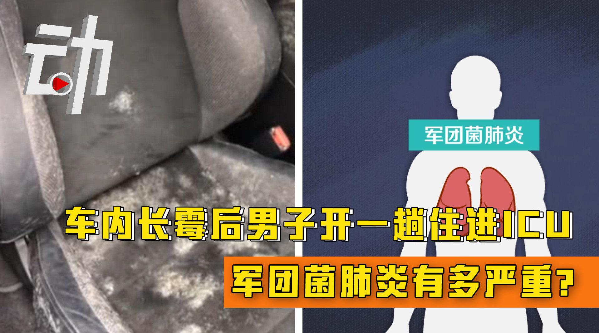 军团菌肺炎有多可怕:男子开长霉的车细菌感染住进icu
