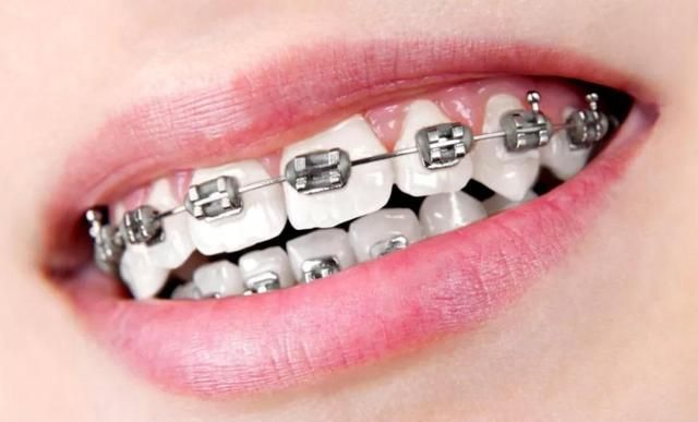 考生因戴金属牙套不能进考场 幸亏警察叔叔的协助才顺利进入考场休闲区蓝鸢梦想 - Www.slyday.coM 考生因戴金属牙套不能进考场 幸亏警察叔叔的协助才顺利进入考场休闲区蓝鸢梦想 - Www.slyday.coM