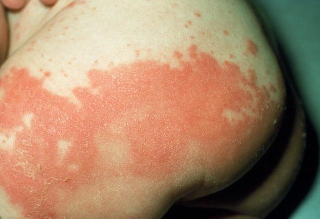 教你4招,轻松呵护宝宝|宝宝|屁股|宝妈_新浪新闻