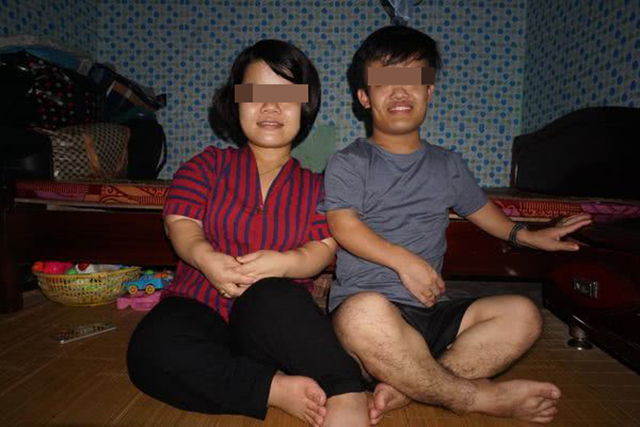 袖珍宝宝如此经历,和她父母密不可分|父母|正常人|侏儒症_新浪新闻
