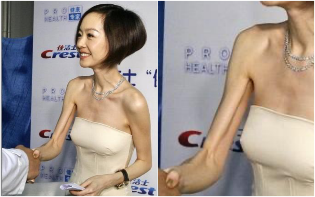 鲁豫虽然瘦,但穿衣服的痛点也蛮明显的.