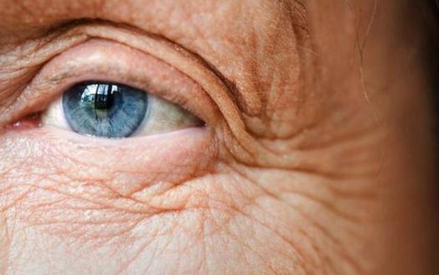 脸上不想长皱纹2种素食尽量少吃皮肤什么状态预示衰老了