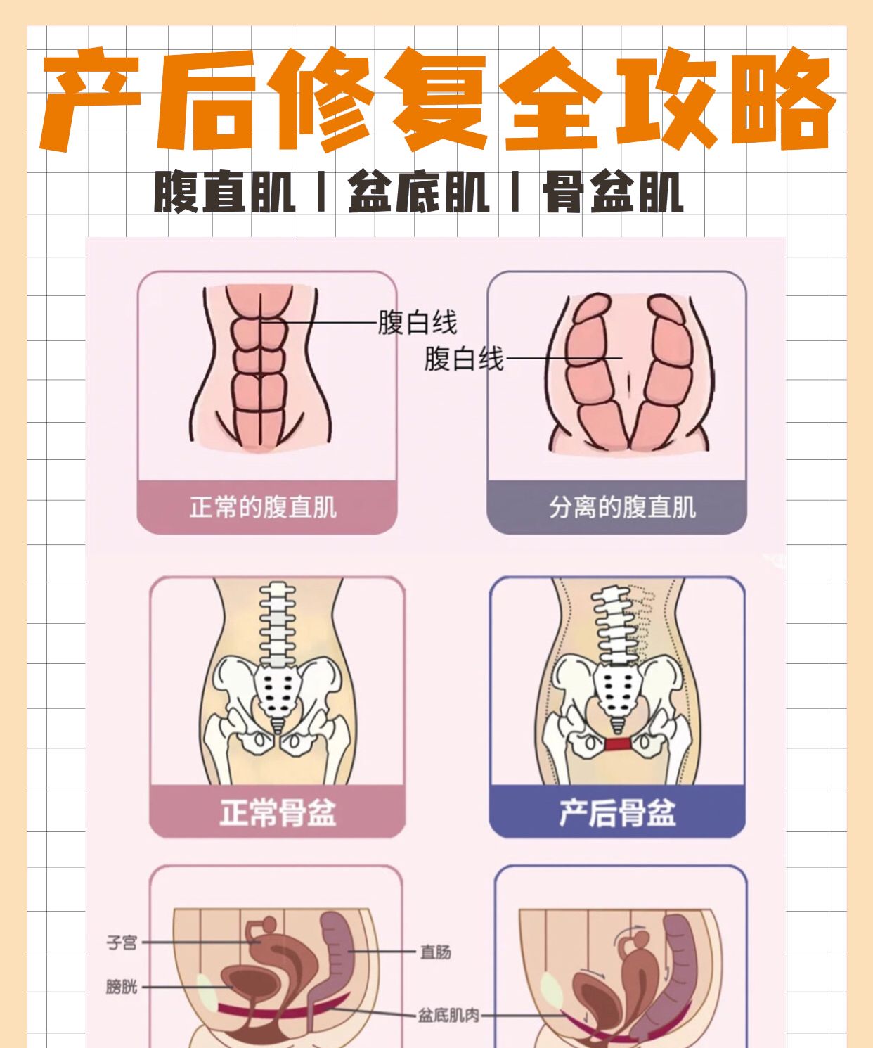 产后修复全攻略盆底肌腹直肌骨盆肌