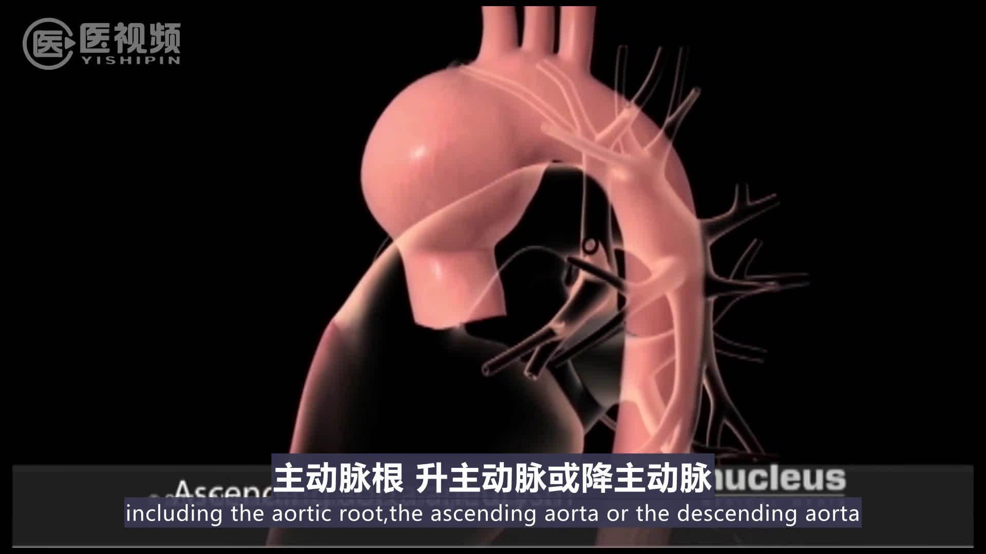 医学双语科普:主动脉的解剖 视频翻译by_新浪新闻