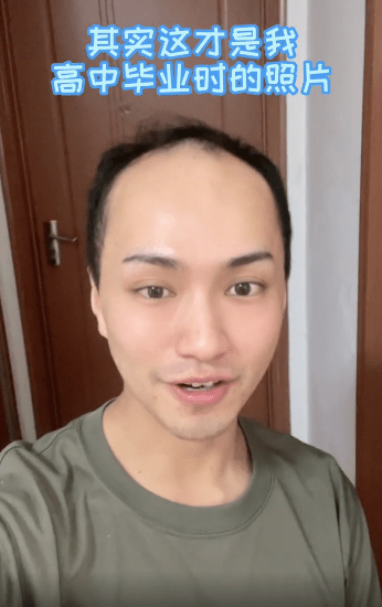 网红楚淇晒高中素颜照皮肤黑穿着土气一点也不帅如今完成逆