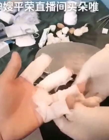 主播二驴夫妇直播间卖山寨手机爆炸：消费者手指受伤(图4)
