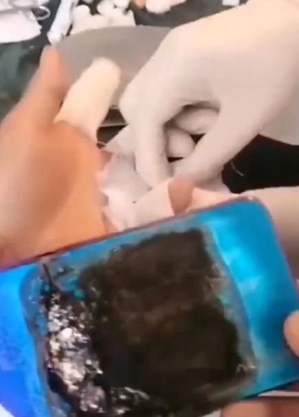 主播二驴夫妇直播间卖山寨手机爆炸：消费者手指受伤(图5)