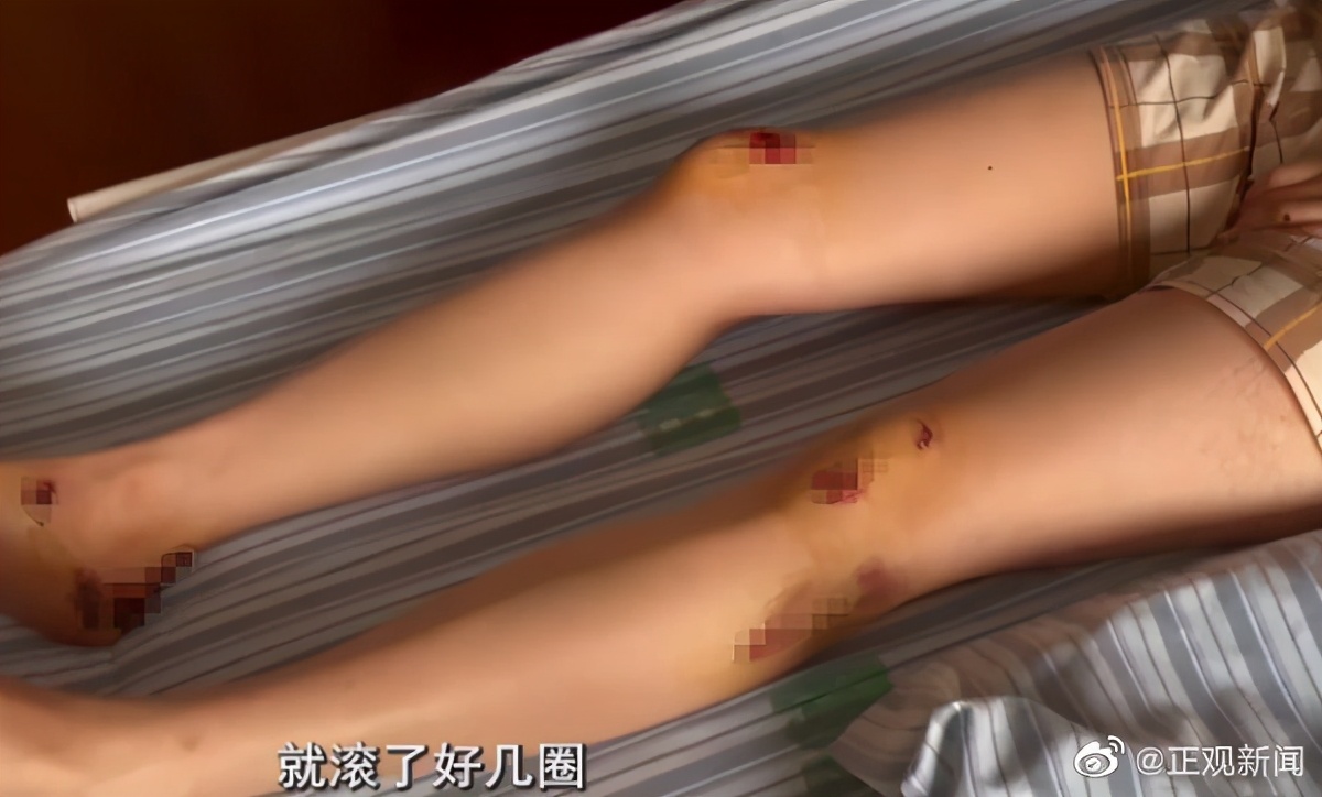 网约车两次改路线,女子跳车骨折,平台:她需要去看看脑子休闲区蓝鸢梦想 - Www.slyday.coM 网约车两次改路线,女子跳车骨折,平台:她需要去看看脑子休闲区蓝鸢梦想 - Www.slyday.coM