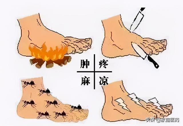 糖尿病患者脚麻木疼痛发凉试试这一方法