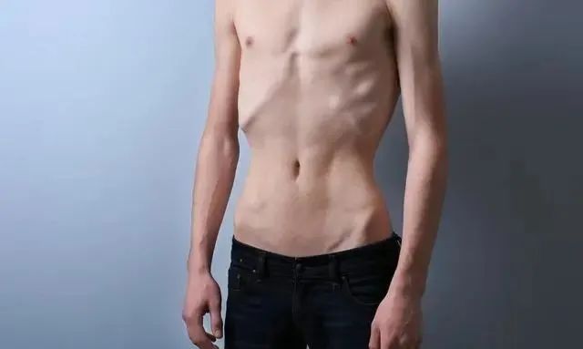 45岁女子，查出肝癌，厨房里有这3样物品，最好查一下肝功休闲区蓝鸢梦想 - Www.slyday.coM