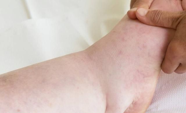 感染HPV的人,身体会有2个异常,即使占1个,也要多加小心休闲区蓝鸢梦想 - Www.slyday.coM