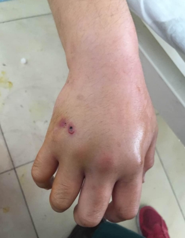 泡了几个月的蛇酒开封后毒蛇不仅复活还咬人这是怎么回事
